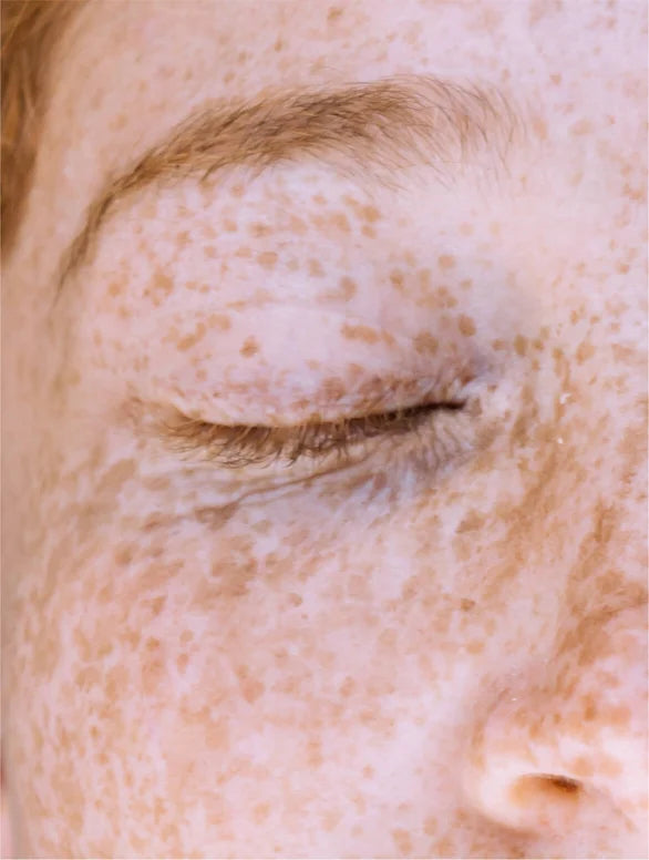 Dark Spot Face Cream with Kojic Acid